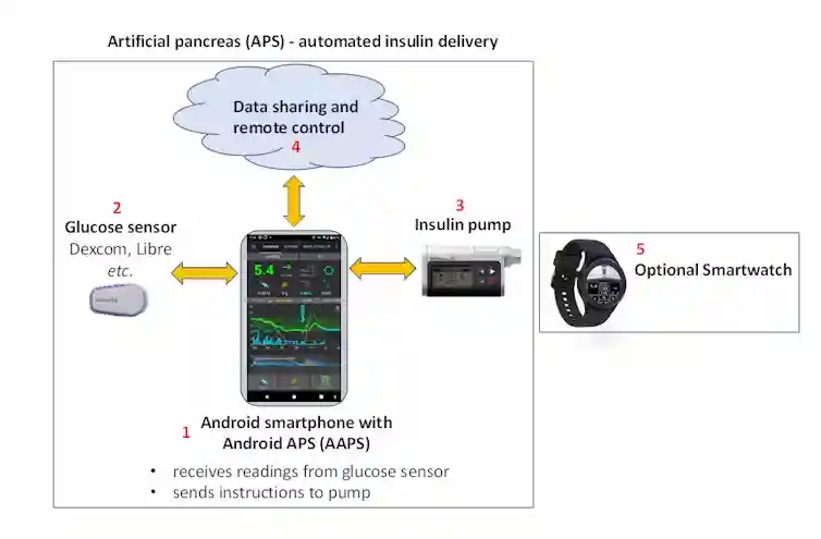 Elementos de un páncreas artificial de código libre. AndroidAPS Community