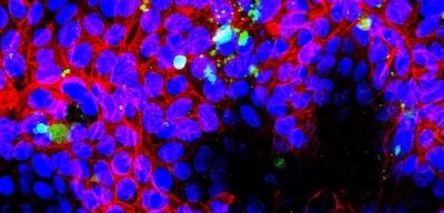 Las imágenes de microscopía muestran la capacidad de los nanoplásticos para interactuar con las células intestinales